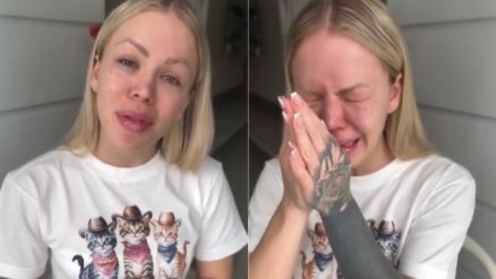 Modelo denuncia queimaduras após cirurgias plásticas em MG